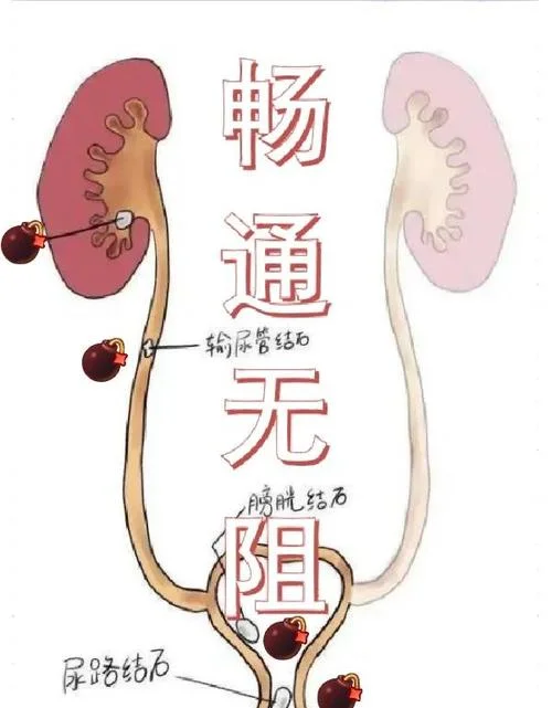 排石颗粒原理_1