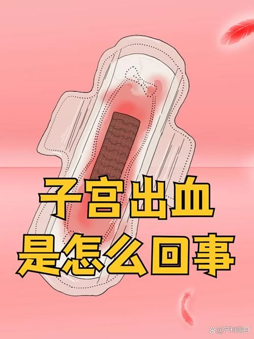 子宫出血怎么办_2