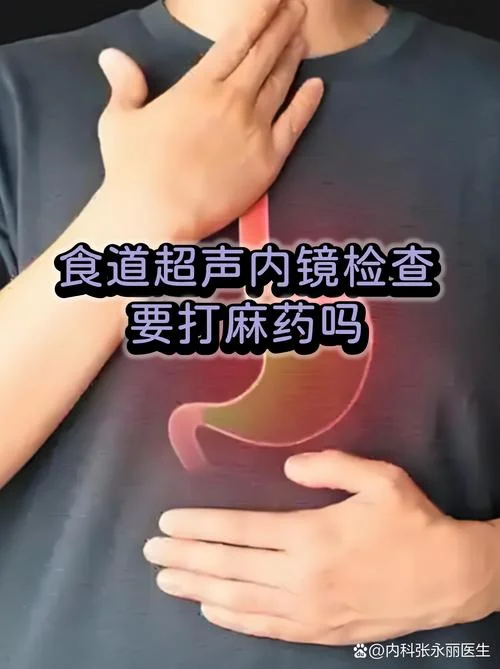 食管镜在哪查_1
