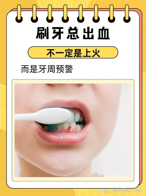 做梦梦见刷牙出血-梦中刷牙出血