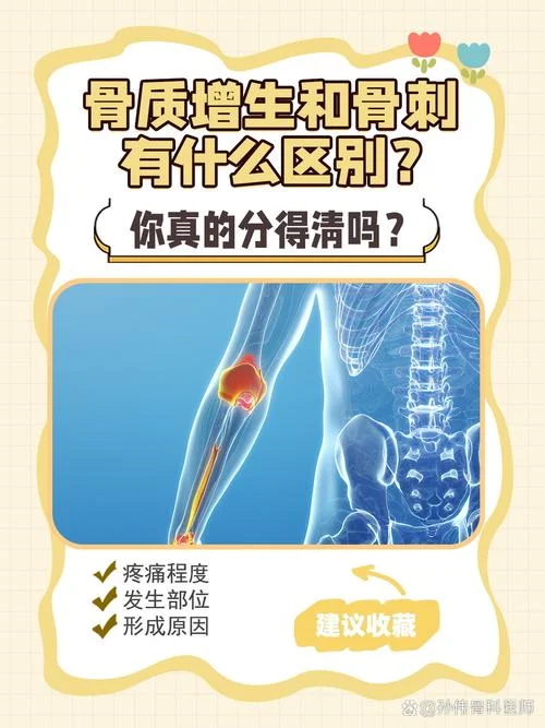 有骨刺了怎么办-有骨刺怎么办