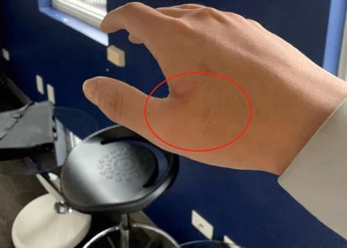 加拿大中国留学生被吃_1