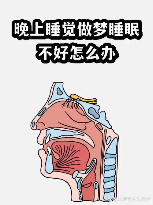 睡眠不好还经常做梦-多梦睡眠差
