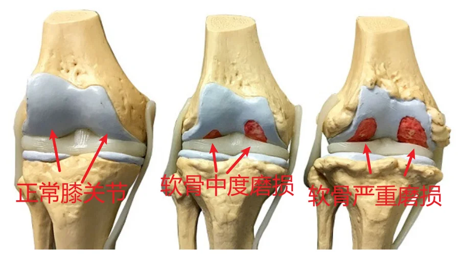膝盖反面叫什么_2