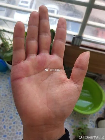 m字纹手相的女人左手_2