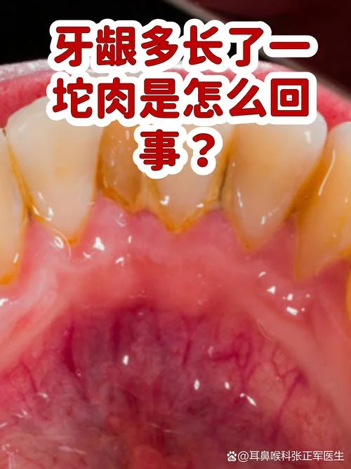 多余的牙齿叫什么牙_1