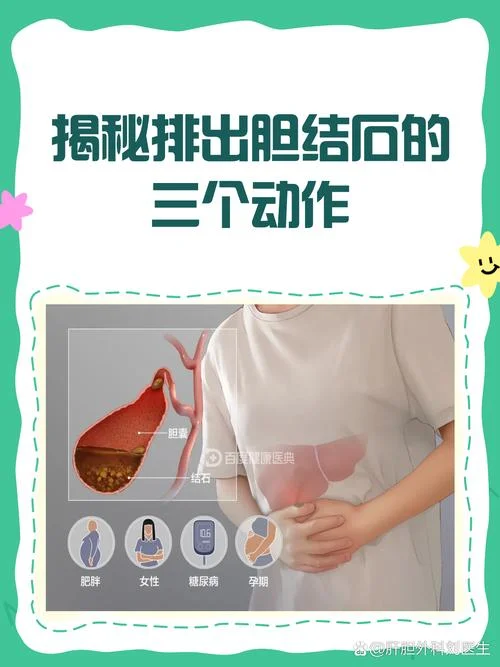 如何查有没有胆结石_1