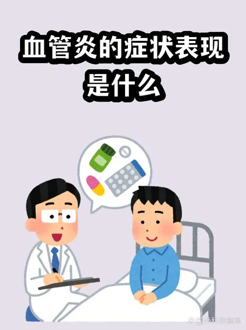血管炎叫什么_1