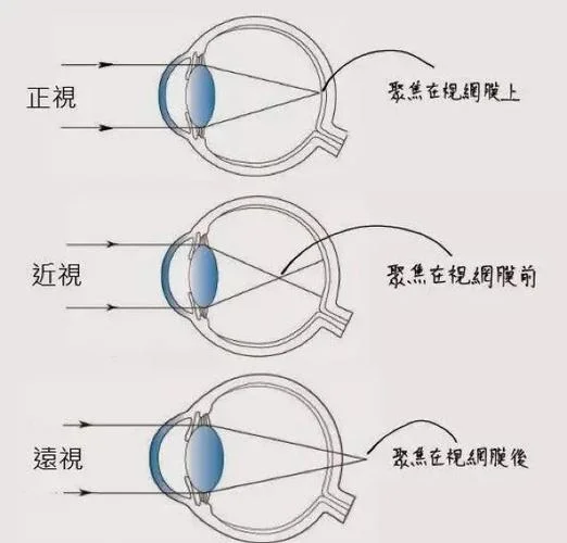 色弱眼镜的原理_2