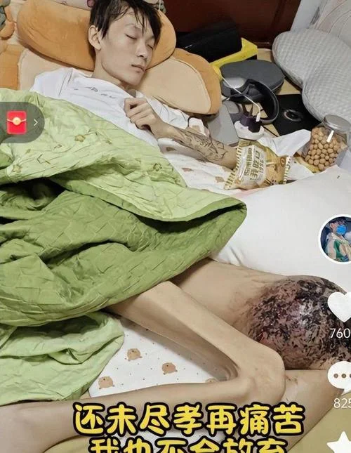 骨肉瘤是个什么病_1
