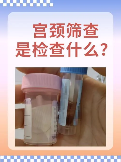 妇科tct检查是查什么_1