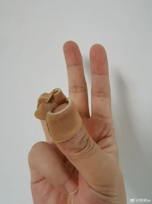 梦到指甲劈了_2