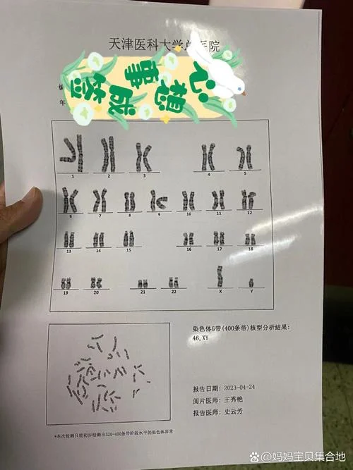 染色体在哪查_1