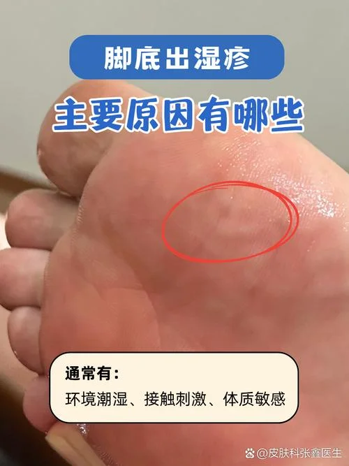 按脚脚心痒是为什么_2