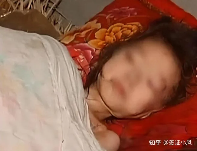 梦到好多蛆虫爬到身上_2
