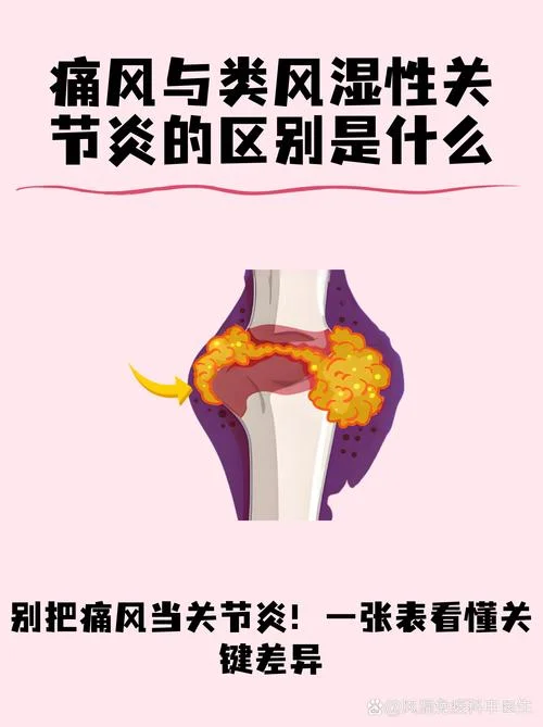 什么是痛风病_1
