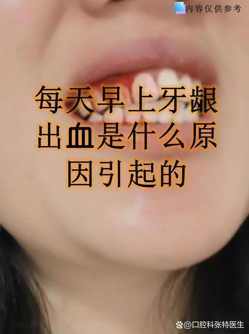 做梦梦到牙齿松动流血_1
