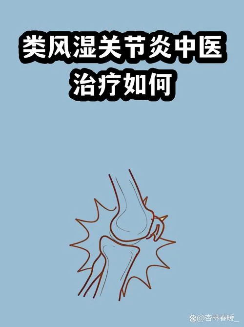 什么是风湿病怎么治疗_1