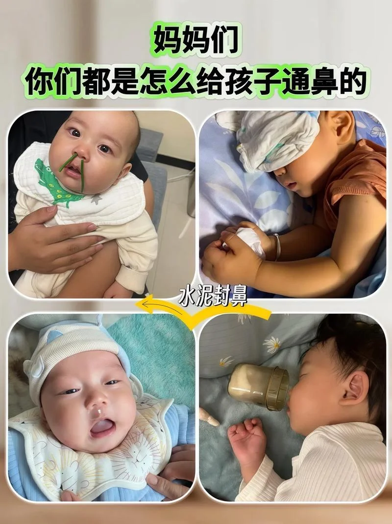 小宝宝流鼻涕鼻塞怎么办-宝宝流鼻涕鼻塞怎么办