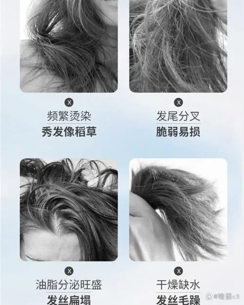 烫头发头皮烫伤怎么办-烫发烫头怎么办