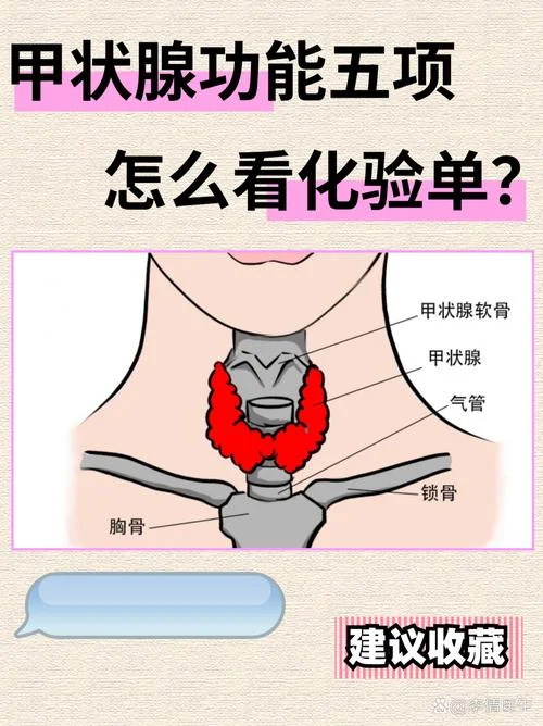 去医院如何查甲亢-医院查甲亢方法