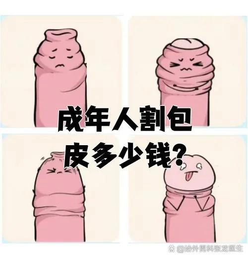 包皮手术需要多少钱-包皮手术花费参考