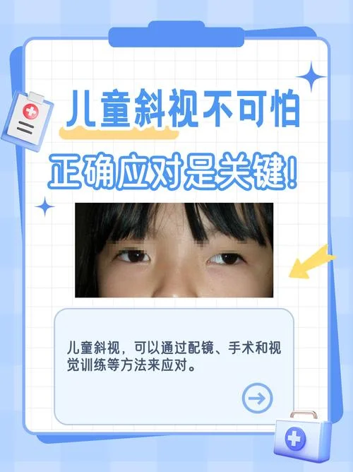 眼睛有斜视怎么办_1