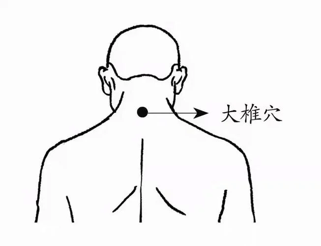 凯里哪里学艾灸-凯里学艾灸地点