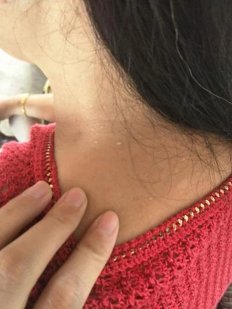 梦见自己脖子肉很多_1