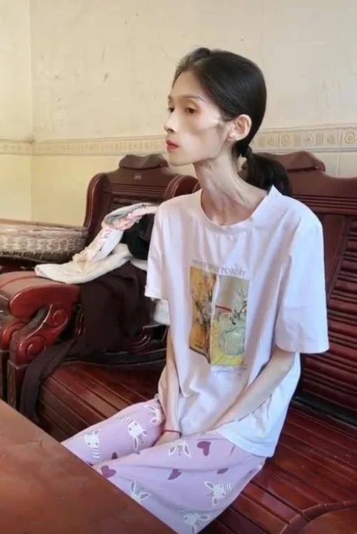 梦见病人瘦了_2