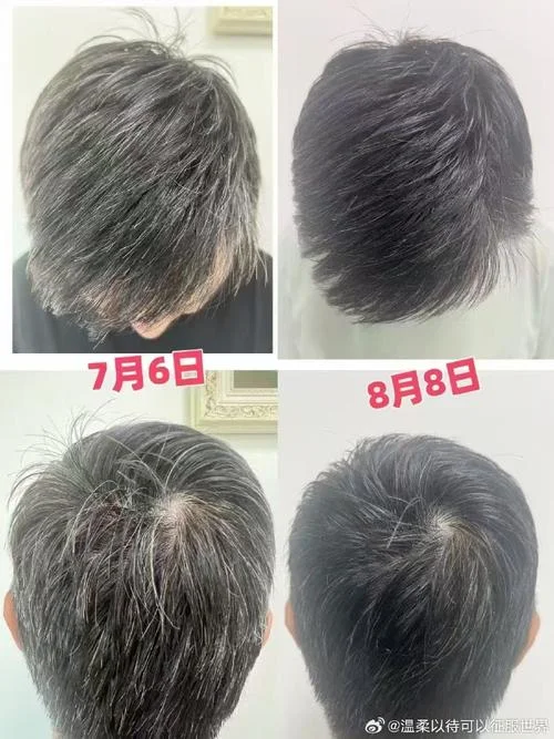梦见白发变黑发_1