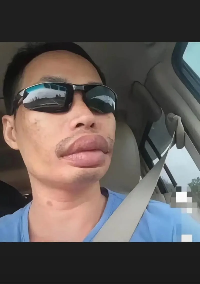 上嘴唇突出的男人面相_2