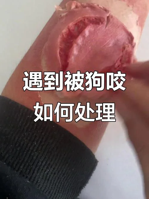 梦到被狗狗咬了_1