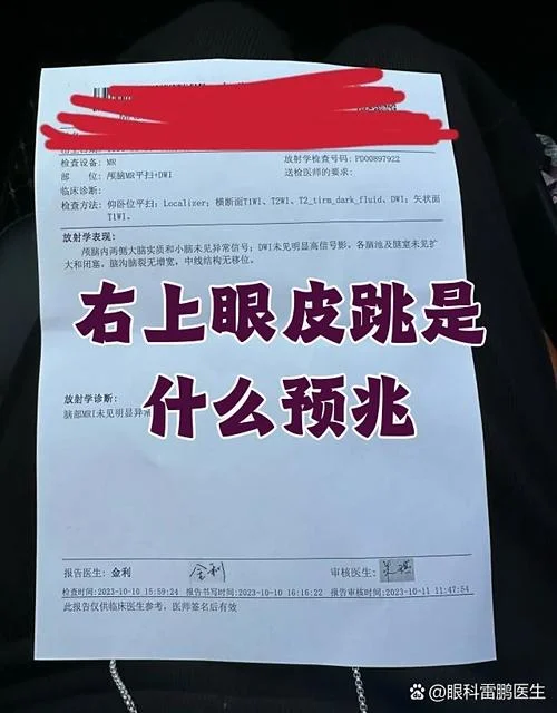 梦见右眼皮跳-梦见右眼皮跳