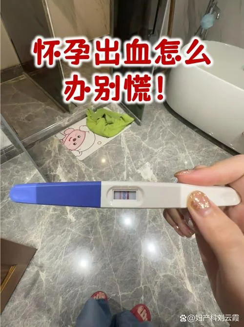 孕妇梦到自己杀人见血_1