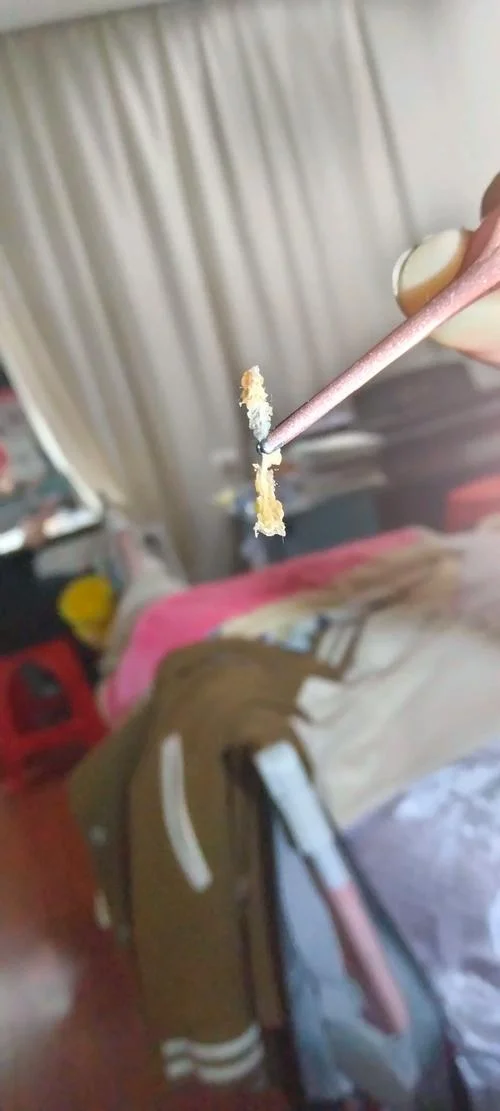 梦到掏耳朵掏很多耳屎_2