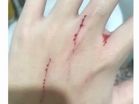 梦到白猫咬我的手_1