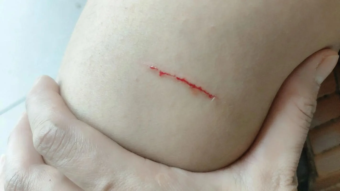 梦见被猫抓着了不放-猫抓不放梦境