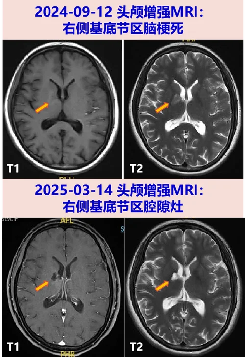 头颅ct检查什么项目_2