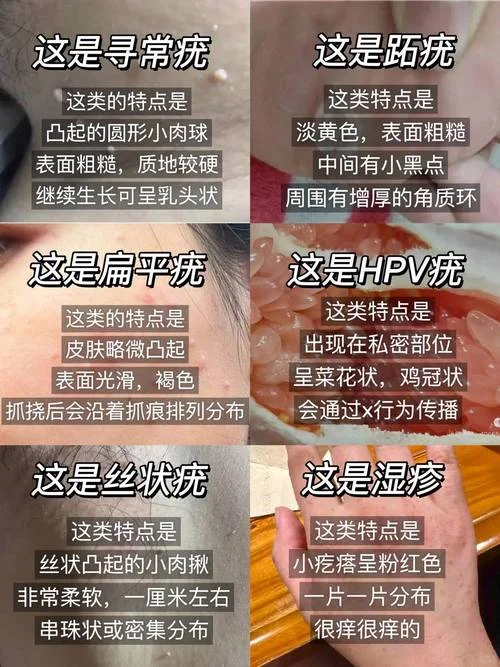 南京在哪里可以查hpv_1