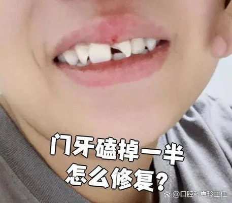 梦见右门牙掉了一半_2