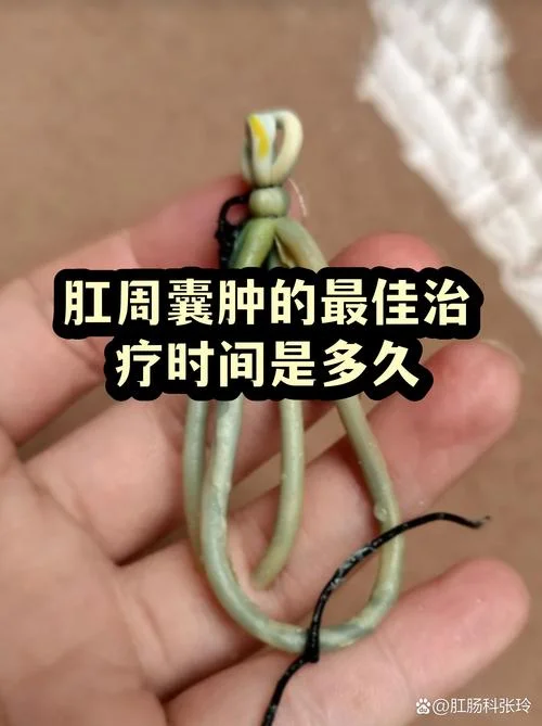 肛门囊肿该怎么办_1