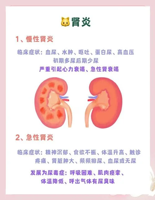 如何查有没有肾炎_1
