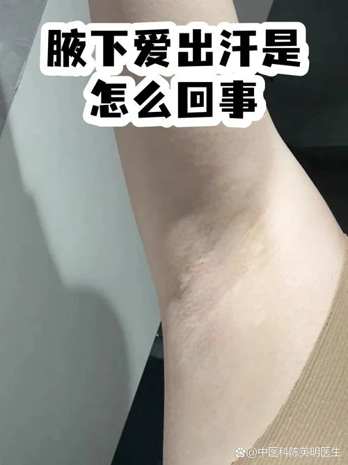腋下大量出汗怎么办_1