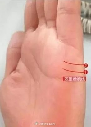 手相婚姻线三条图解-手相婚姻线三图解