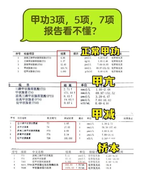 如何查自己是不是甲减_2