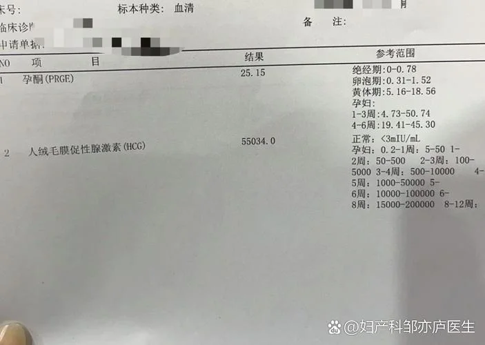 做什么能查出自己怀孕_1