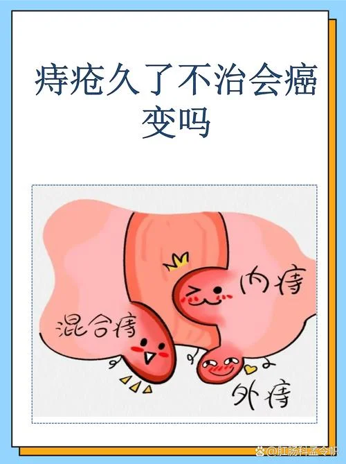 什么是外痔是癌症_1