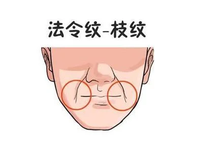 法令纹看运势男-男命看法令纹运势