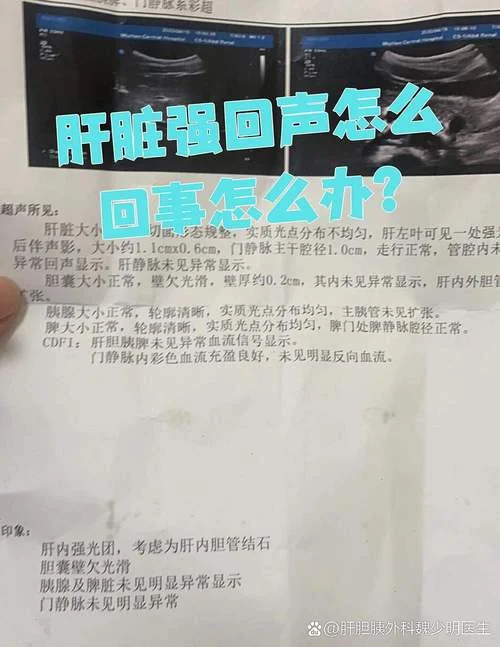 什么是肝实质回声密集_1